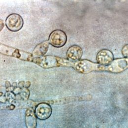 Candida albicans kvasinky